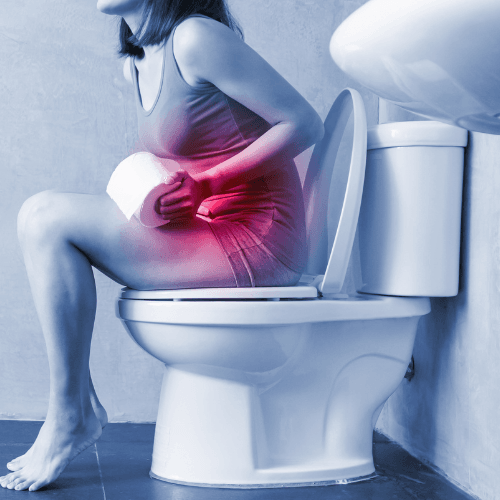 Constipação Crônica: por que fibra e água não resolvem em todo caso