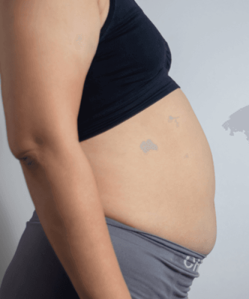 Distensão Abdominal Após as Refeições: causas funcionais que ninguém comenta