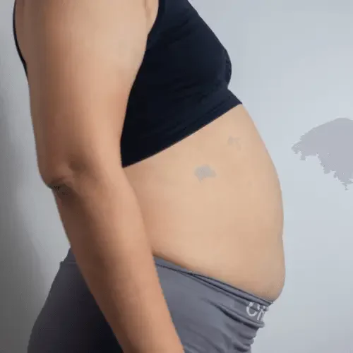 Distensão Abdominal Após as Refeições: causas funcionais que ninguém comenta