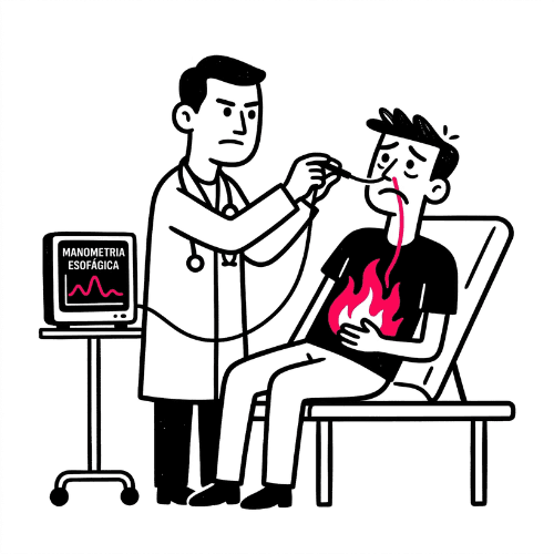 Manometria Esofágica: o que é, para que serve e o que fazer depois do resultado