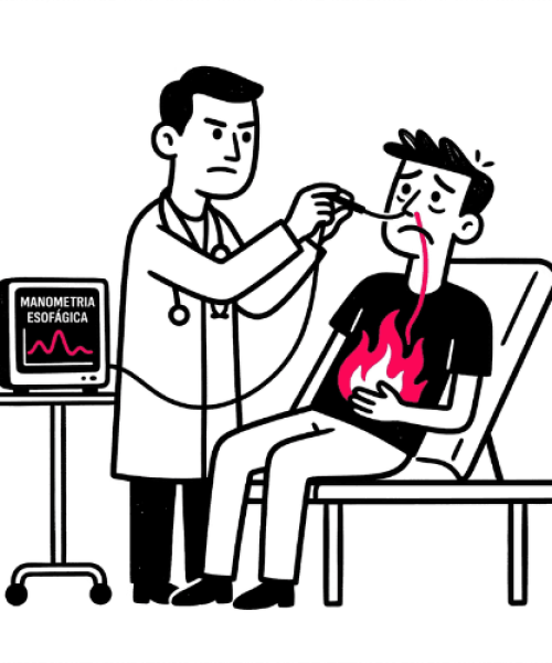 Manometria Esofágica: o que é, para que serve e o que fazer depois do resultado