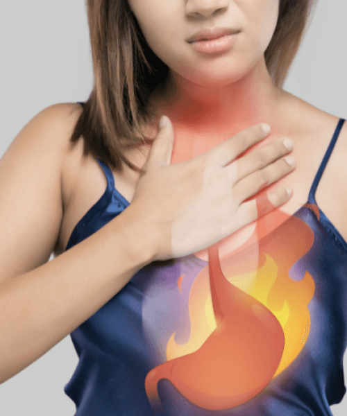 Hérnia de Hiato e Fisioterapia: o que poucos te contam