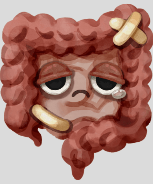 Fisioterapia para Intestino Irritável: uma abordagem diferente